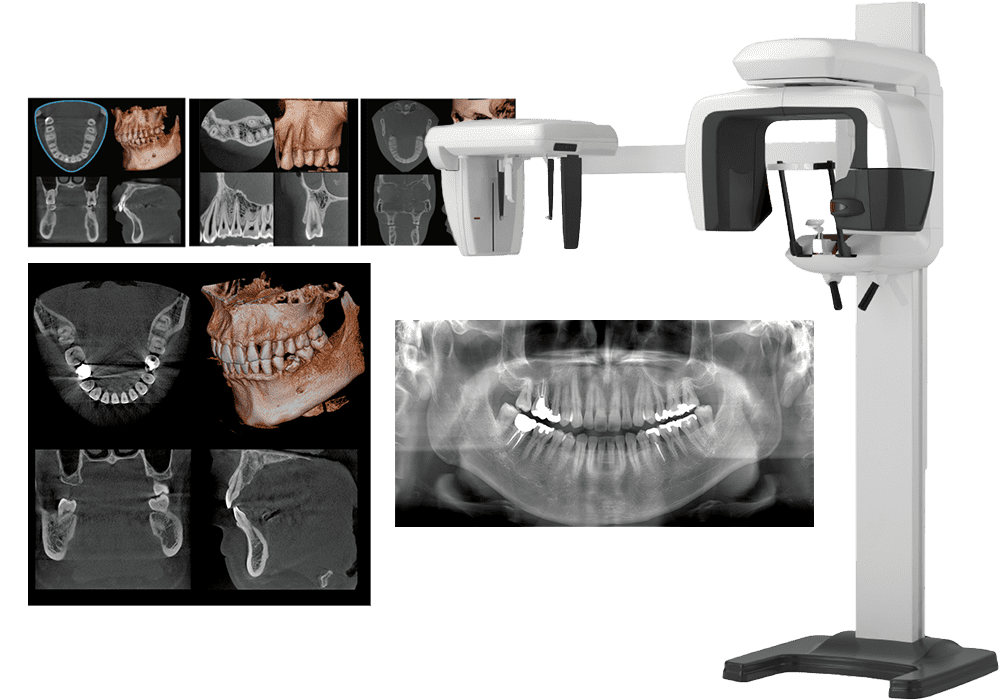 歯科用CT・デジタルレントゲン